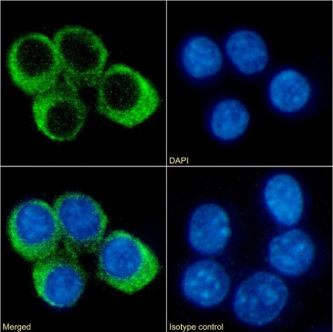 CCRL2 Chimeric Antibody in Immunocytochemistry (ICC/IF)