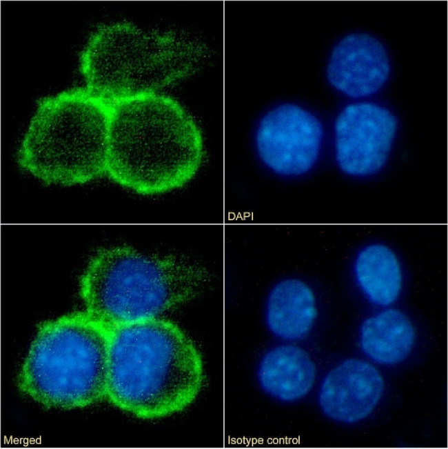 CD40 Chimeric Antibody in Immunocytochemistry (ICC/IF)