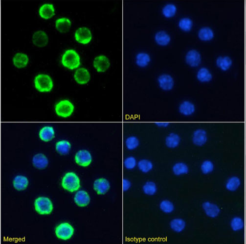 CD20 Chimeric Antibody in Immunocytochemistry (ICC/IF)