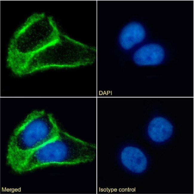 TSPAN1 Chimeric Antibody in Immunocytochemistry (ICC/IF)
