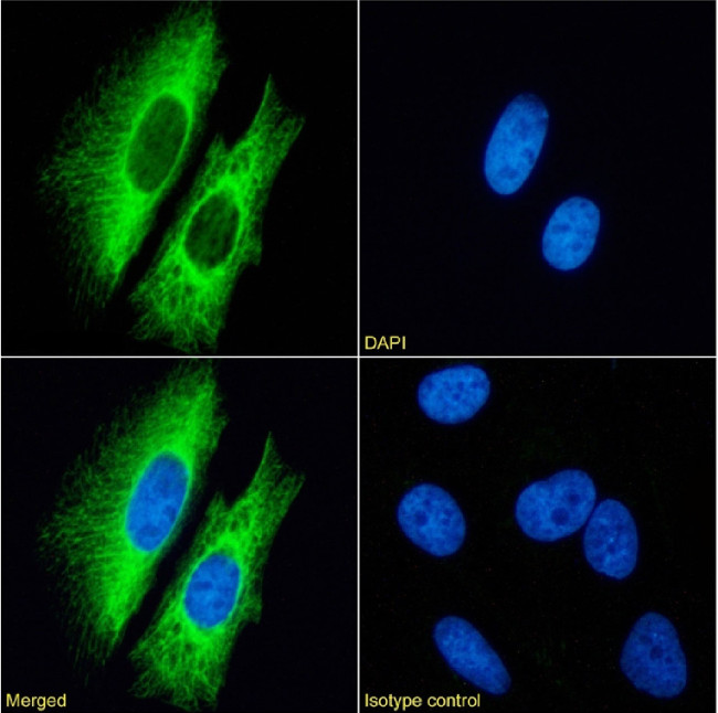Cytokeratin 7 Chimeric Antibody in Immunocytochemistry (ICC/IF)