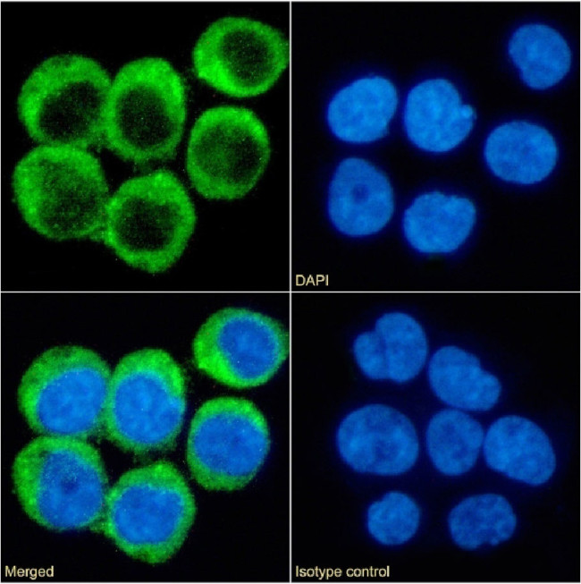 CD40 Chimeric Antibody in Immunocytochemistry (ICC/IF)