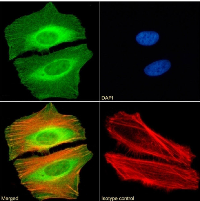 CBX2 Chimeric Antibody in Immunocytochemistry (ICC/IF)