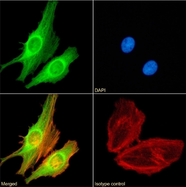 FOXP4 Chimeric Antibody in Immunocytochemistry (ICC/IF)