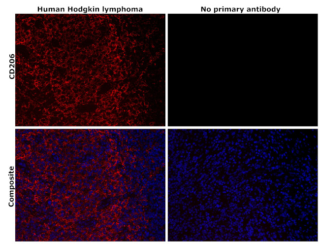 CD206 (MMR) Antibody in Immunohistochemistry (Paraffin) (IHC (P))