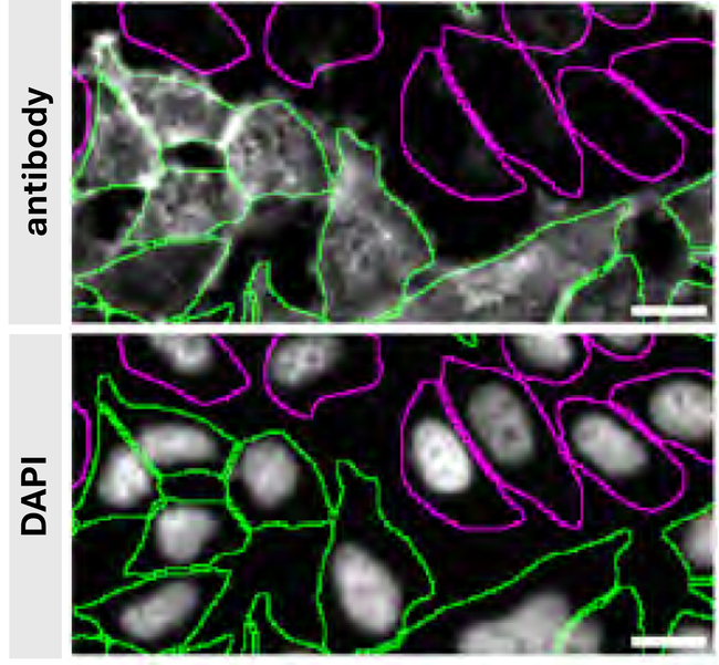 RAB8A Antibody in Immunocytochemistry (ICC/IF)