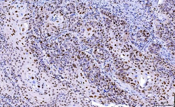 CDK2 Antibody in Immunohistochemistry (Paraffin) (IHC (P))