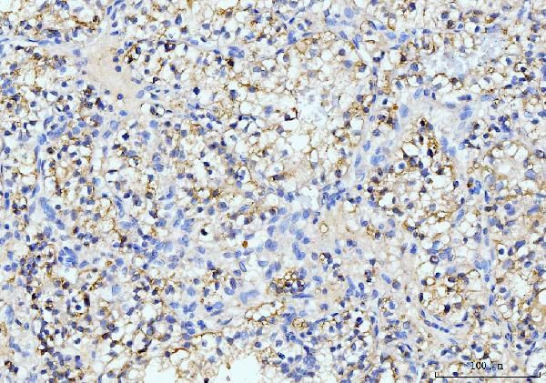 ITCH Antibody in Immunohistochemistry (Paraffin) (IHC (P))