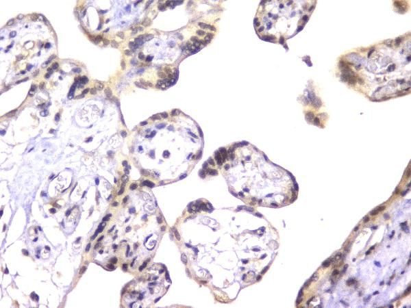 EWSR1 Antibody in Immunohistochemistry (Paraffin) (IHC (P))