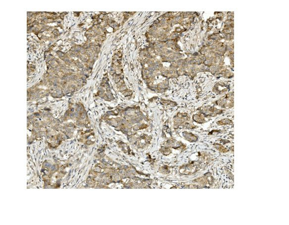 MUT Antibody in Immunohistochemistry (Paraffin) (IHC (P))