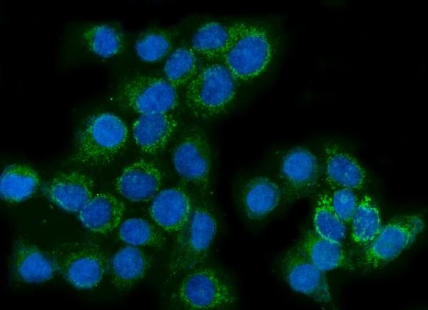 Glutaminase Antibody in Immunocytochemistry (ICC/IF)