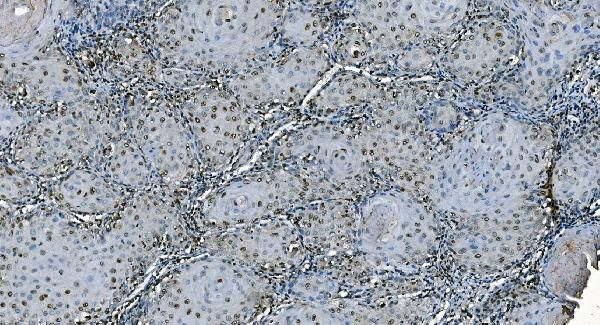 CDC45L Antibody in Immunohistochemistry (Paraffin) (IHC (P))
