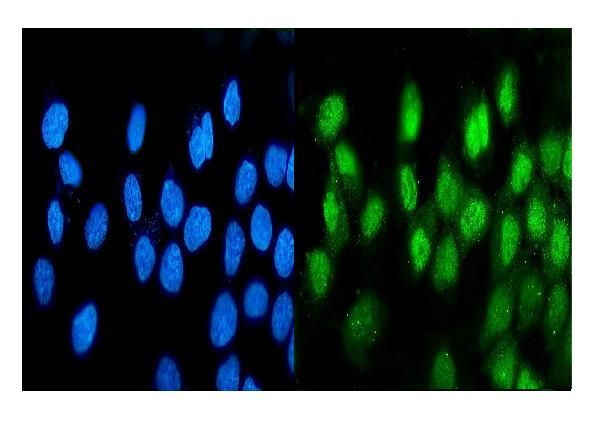 ATF1 Antibody in Immunocytochemistry (ICC/IF)