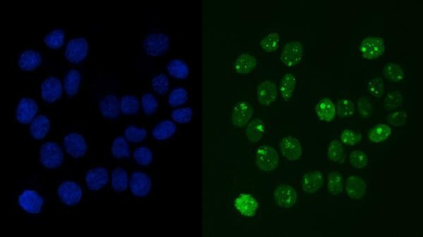 RCC1 Antibody in Immunocytochemistry (ICC/IF)