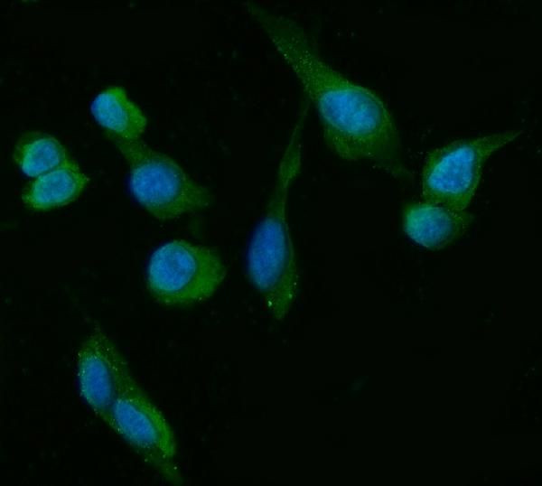 HSD3B1 Antibody in Immunocytochemistry (ICC/IF)