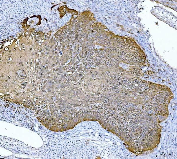 Maspin Antibody in Immunohistochemistry (Paraffin) (IHC (P))