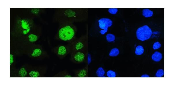 PCQAP Antibody in Immunocytochemistry (ICC/IF)
