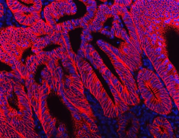 NKCC1 Antibody in Immunohistochemistry (Paraffin) (IHC (P))