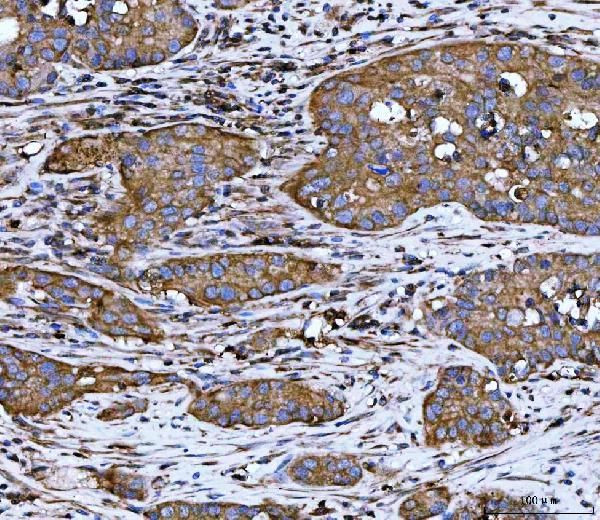 WDR1 Antibody in Immunohistochemistry (Paraffin) (IHC (P))