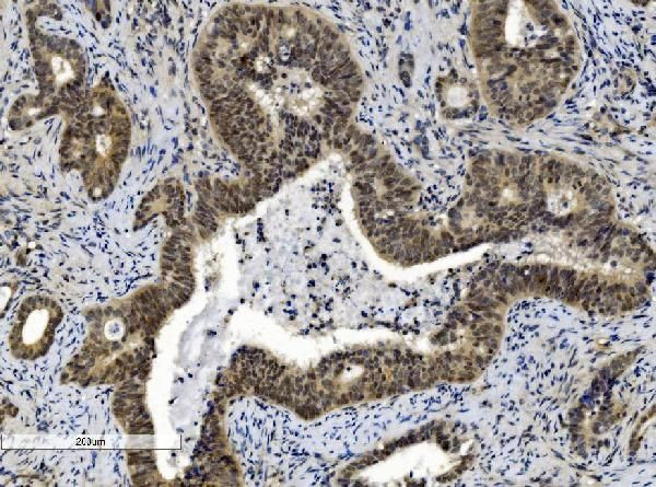 CBX8 Antibody in Immunohistochemistry (Paraffin) (IHC (P))