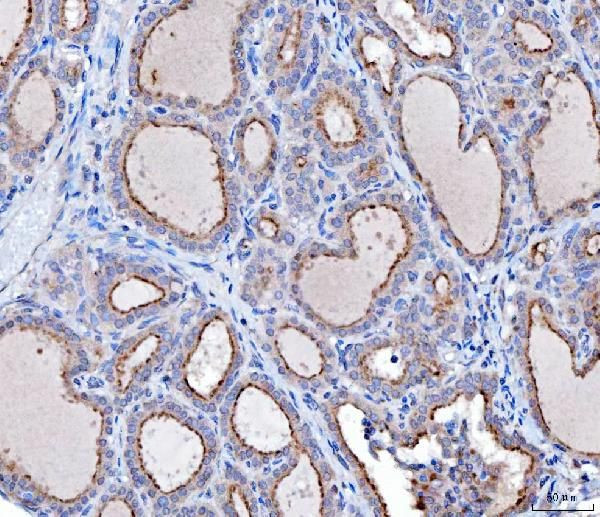 KLHL12 Antibody in Immunohistochemistry (Paraffin) (IHC (P))