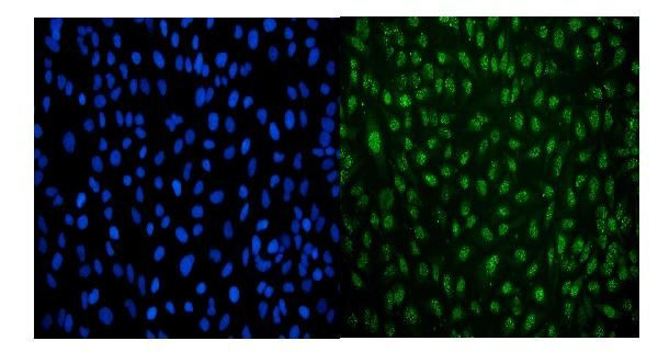 LSM8 Antibody in Immunocytochemistry (ICC/IF)
