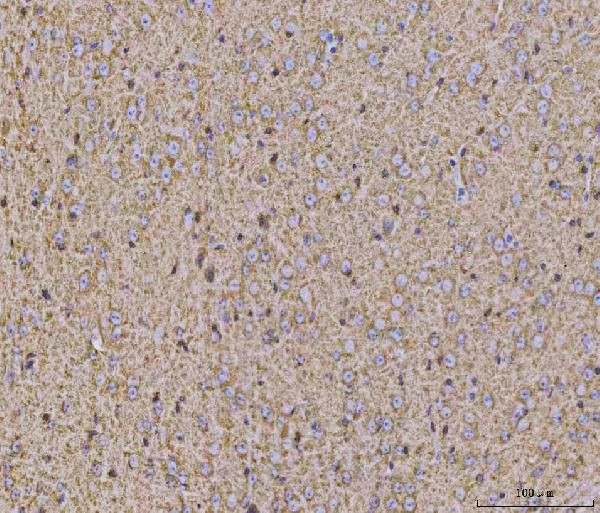 Calcineurin B Antibody in Immunohistochemistry (Paraffin) (IHC (P))