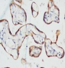 Cytokeratin 1 Antibody in Immunohistochemistry (Paraffin) (IHC (P))