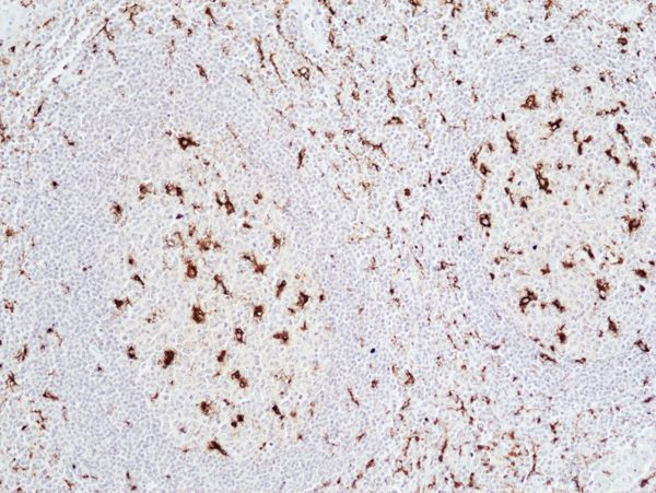 CD68 Antibody in Immunohistochemistry (Paraffin) (IHC (P))