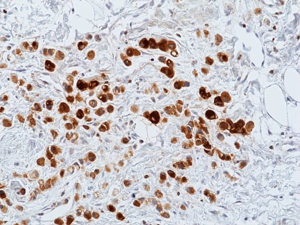 GCDFP-15 Antibody in Immunohistochemistry (Paraffin) (IHC (P))
