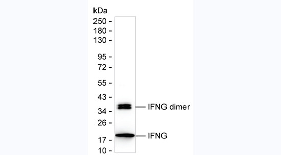 IFN gamma Antibody in Western Blot (WB)