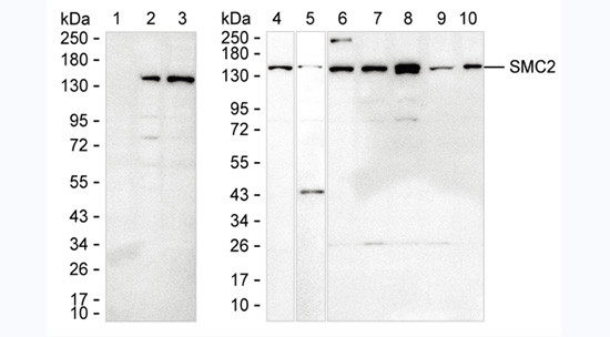 SMC2 Antibody in Western Blot (WB)
