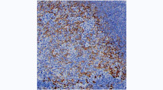 Complement C4a Antibody in Immunohistochemistry (Paraffin) (IHC (P))