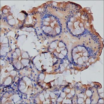CD66e (CEA) Antibody in Immunohistochemistry (Paraffin) (IHC (P))