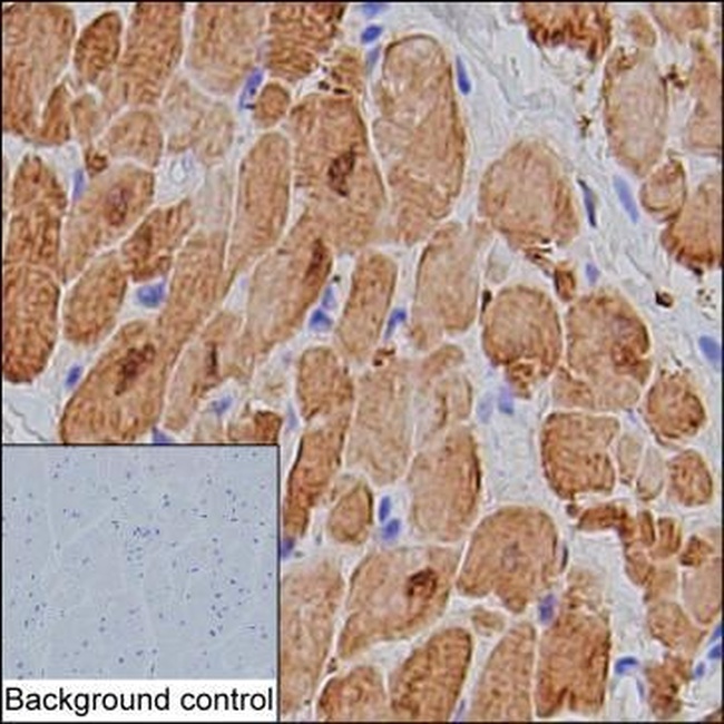 Cardiac Troponin I Antibody in Immunohistochemistry (Paraffin) (IHC (P))