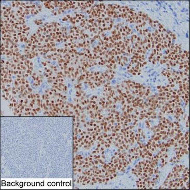 GATA3 Antibody in Immunohistochemistry (Paraffin) (IHC (P))