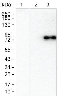 Human IgE Antibody in Western Blot (WB)