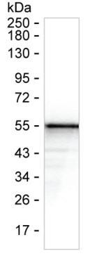 SARS-CoV-2 Nucleocapsid Antibody in Western Blot (WB)