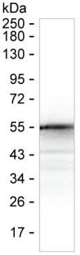 SARS-CoV-2 Nucleocapsid Antibody in Western Blot (WB)
