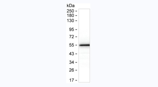 SARS-CoV-2 Nucleocapsid Antibody in Western Blot (WB)