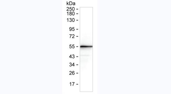 SARS-CoV-2 Nucleocapsid Antibody in Western Blot (WB)