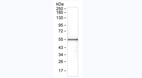 SARS-CoV-2 Nucleocapsid Antibody in Western Blot (WB)