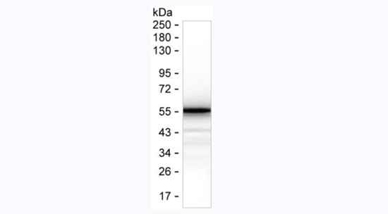 SARS-CoV-2 Nucleocapsid Antibody in Western Blot (WB)