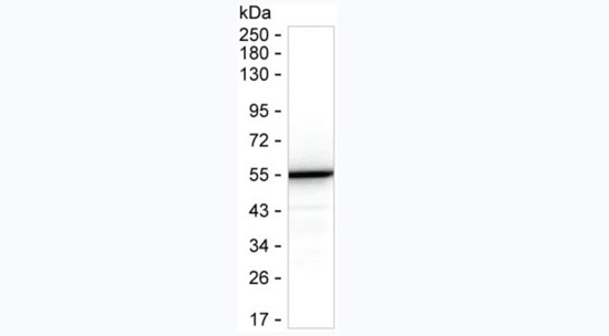 SARS-CoV-2 Nucleocapsid Antibody in Western Blot (WB)