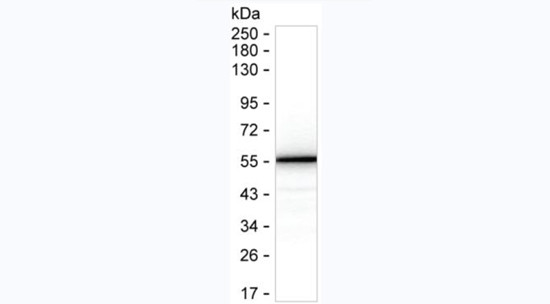 SARS-CoV-2 Nucleocapsid Antibody in Western Blot (WB)