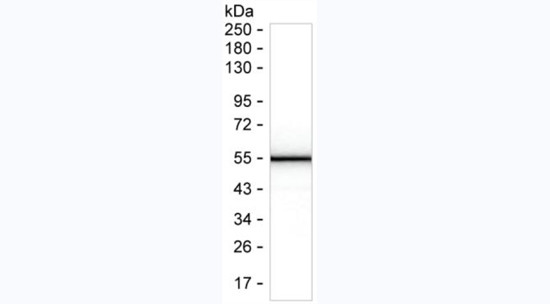 SARS-CoV-2 Nucleocapsid Antibody in Western Blot (WB)