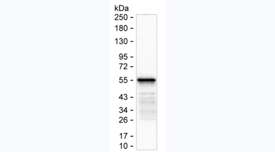 SARS-CoV-2 Nucleocapsid Antibody in Western Blot (WB)
