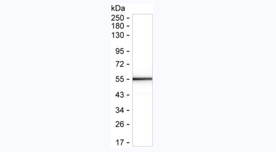SARS-CoV-2 Nucleocapsid Antibody in Western Blot (WB)