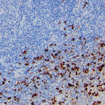 Lambda light chain Antibody in Immunohistochemistry (Paraffin) (IHC (P))