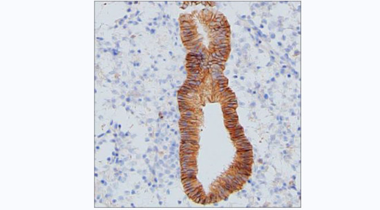 CMTM6 Antibody in Immunohistochemistry (Paraffin) (IHC (P))